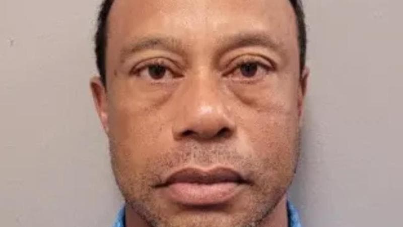 Tiger Woods trovato con due compresse di idrocodone: "Occhi arrossati e pupille dilatate" 1