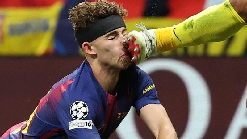 Tensione in Atletico-Barcellona: Musso colpisce Fermin al volto e il calciatore rimane a terra 1