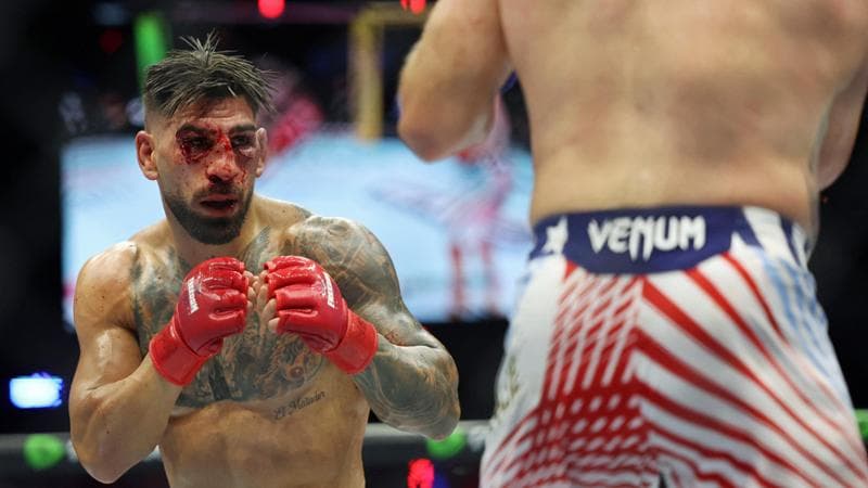 Topuria, gravi le conseguenze della sconfitta nel combattimento di MMA di fronte a Trump: fratture alle orbite oculari. 1