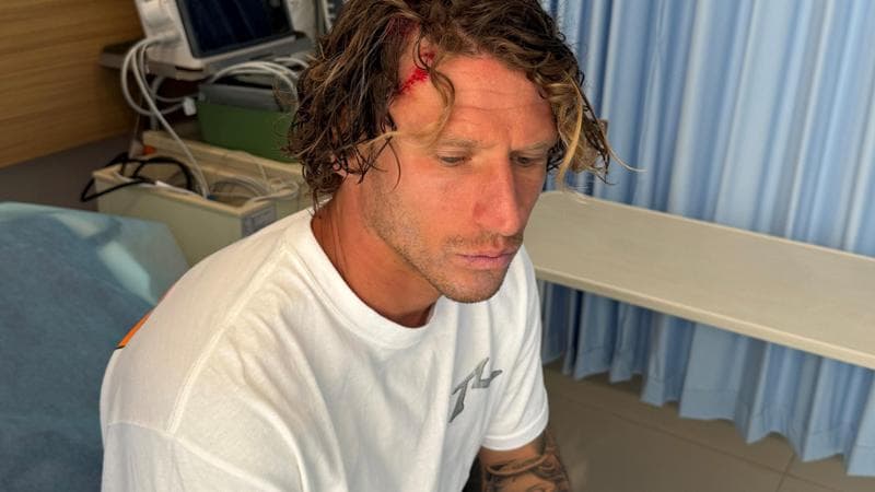 Rudy Ghiara coinvolto in un incidente in Indonesia mentre si allena. 1