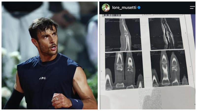 Lorenzo Musetti, frattura al dito: addio anche a Tokyo 1