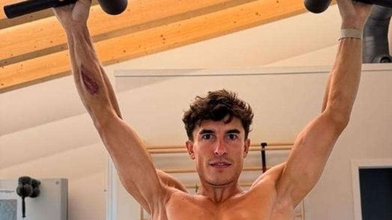 Marc Marquez e la foto impressionante del braccio operato sette volte, che ha rischiato di perdere 1